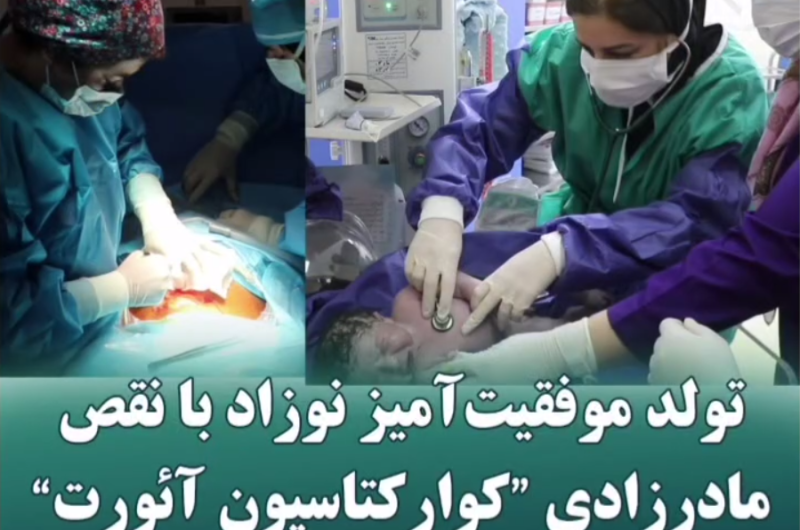 تولد موفقیت آمیز نوزاد با نقص مادزادی “کوارکتاسیون آئورت توسط تیم پزشکی